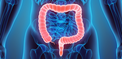 c5c47a2769379c1f61080a1daac7eb46-1 14 وصفة منزلية لعلاج حرقة الشرج والمستقيم