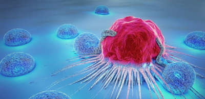 ce10e5aa02447da4b91bcd213f428a3d-1 معلومات عامة عن السرطان