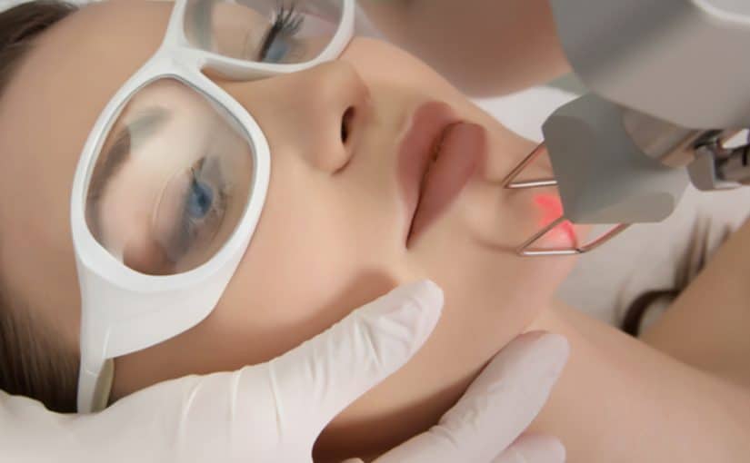 co2-laser-lasers-click-thru-pics-500x383402x-825x510-2 فراكشنال للوجه