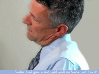 جانب العنق جانب العنق