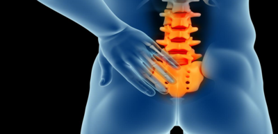 d34a2f66169f26d8318e0dd7ab18ef91-1 ماذا تعرف عن الناسور العصعصي (كيس الشعر)؟