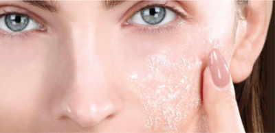 d7c1bf3de06bf925fb9caa24c04f619b-1 تقشر الجلد: أسباب وعلاجات طبيعية