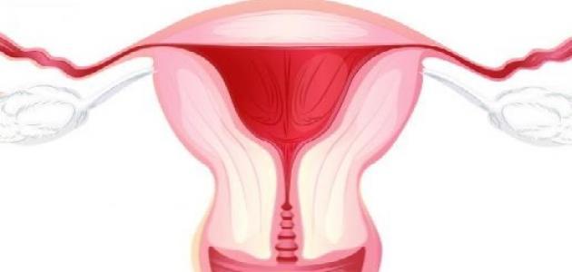 أسباب التهاب المهبل