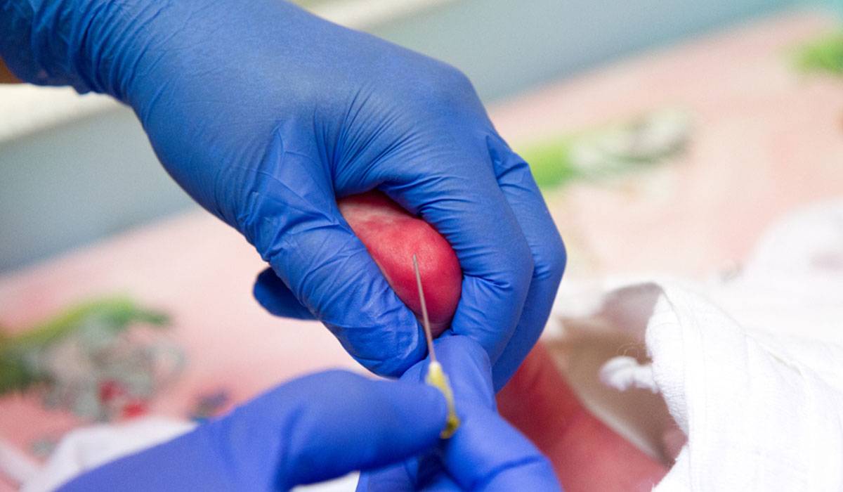 أمراض يكشفها تحليل كعب القدم