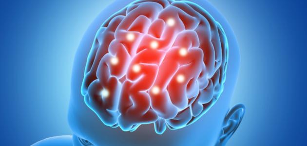 أمراض الغدة النخامية وأعراضها