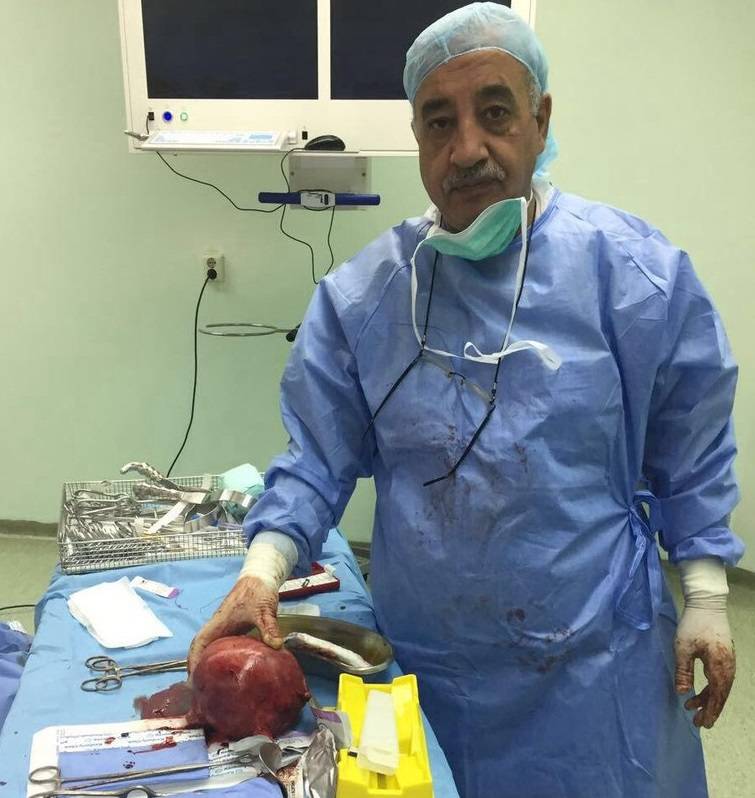 إستئصال الرحم