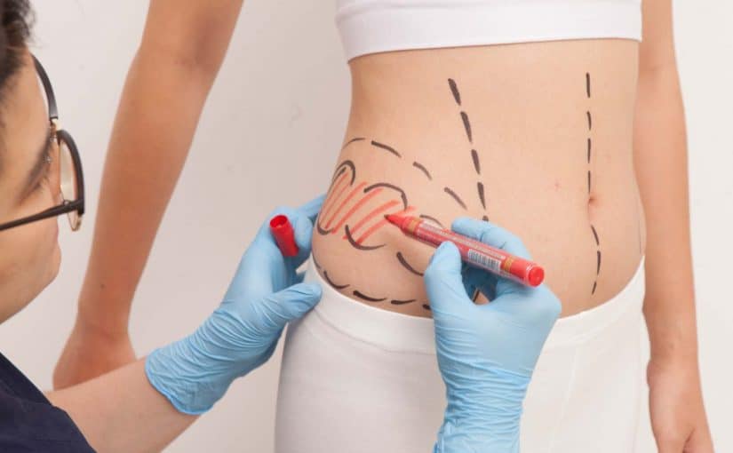 اسعار عمليات شفط الدهون في جدة