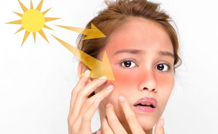 d8a7d8b6d8b1d8a7d8b1-d8a7d984d8b4d985d8b3-d8b9d984d98a-d8a7d984d8a8d8b4d8b1d987-825x510-2 اضرار الشمس علي البشره