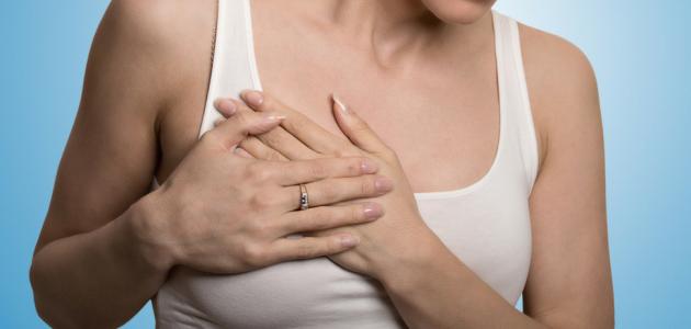 افرازات صفراء من الثدي