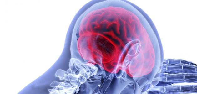 الأمراض العقلية