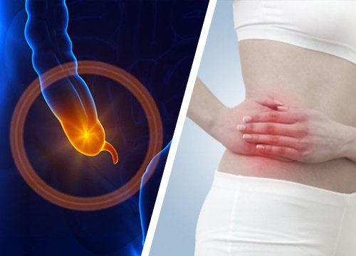 أعراض التهاب الزائدة الدودية