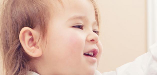 التهاب الغدة النكافية