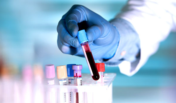 الحمل في الدم