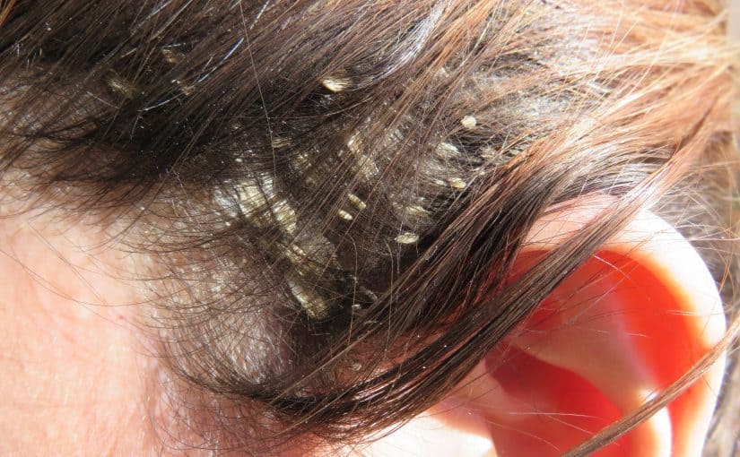 d8a7d984d8b5d8afd981d98ad8a9-d981d98a-d8a7d984d8b4d8b9d8b1-825x510-2 الصدفية في الشعر