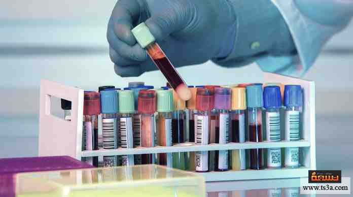 هل تواظب على القيام بالفحوصات الدورية الوقائية في المستشفى؟