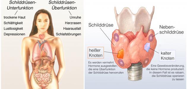 الغدة وتساقط الشعر