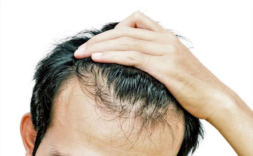 d8a7d986d8a8d8a7d8aa-d8a7d984d8b4d8b9d8b1-825x510-2 طريقة انبات الشعر المتساقط