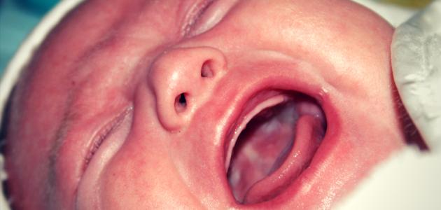 انتفاخ مكان التطعيم