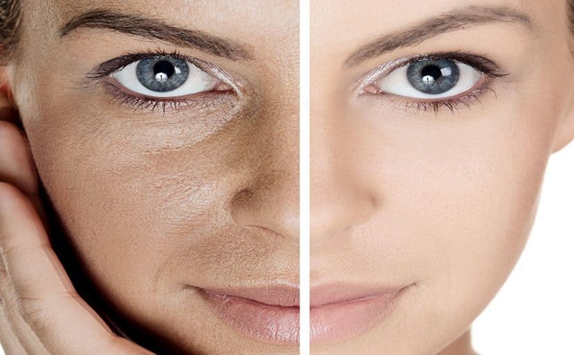 d8a8d984d8a7d8b2d985d8a7-d984d984d988d8acd987-825x510-2 بلازما للوجه