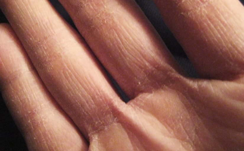 d8aad8aed984d8b5d98a-d985d986-d8aad8b4d982d982-d8a7d984d8a3d98ad8afd98a-d981d989-d981d8b5d984-d8a7d984d8b4d8aad8a7d8a11-825x510-2 تخلصي من تشقق الأيدي فى فصل الشتاء