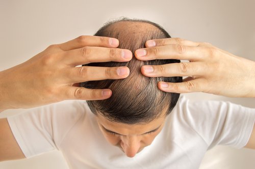 الثعلبة من علامات إجهاد الكبد