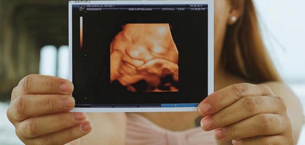 تطور وزن الطفل