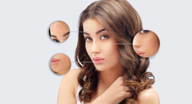 تكثيف الشعر بسرعة مجرب