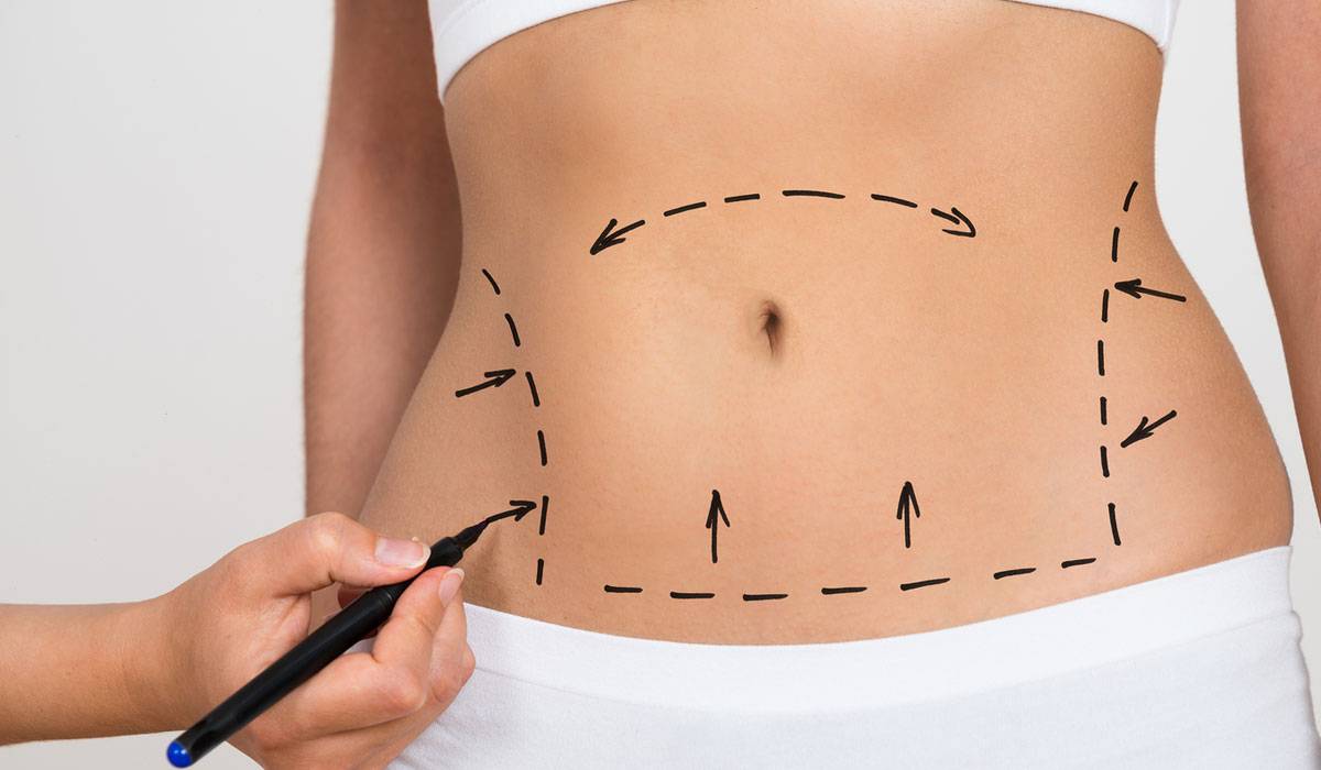 تكلفة-عملية-شد-البطن-بالليزر1