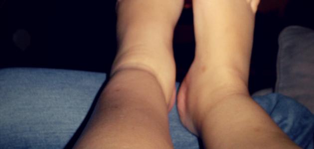 تورم الساقين عند كبار السن