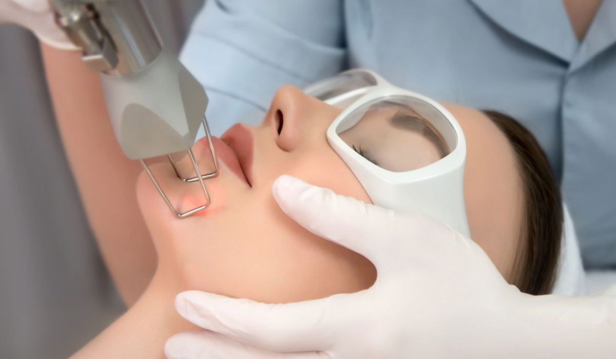 جلسة الفراكشنال ليزر