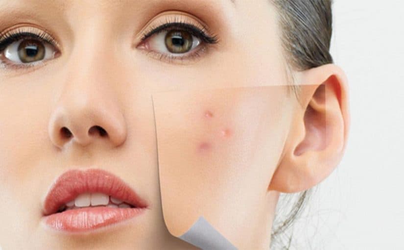 d8add8a8d988d8a8-d8a7d984d988d8acd987-825x510-2 حبوب الوجه