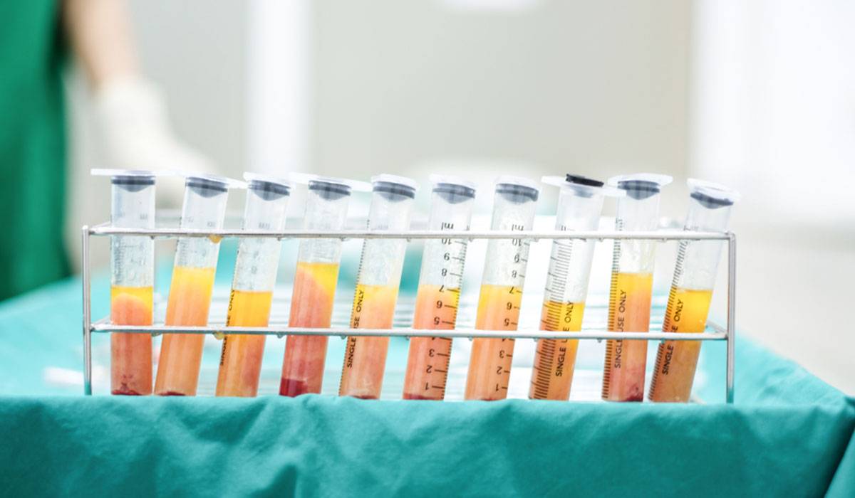 d8add982d986-d8a7d984d8afd987d988d986-d8a7d984d8b0d8a7d8aad98ad987 خطوات عملية حقن الدهون