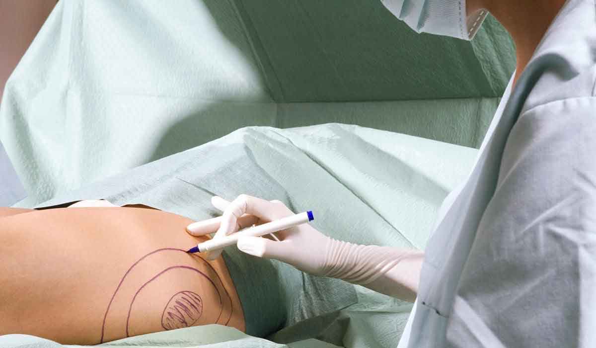 d8add982d986-d8a7d984d8afd987d988d986-d981d98a-d8a7d984d8a7d8b1d8afd8a7d981 حقن-الدهون-في-الارداف