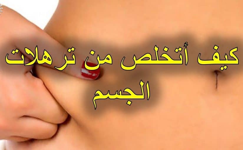 d8aed984d8b7d8a7d8aa-d984d984d8aad8aed984d8b5-d985d986-d8aad8b1d987d984d8a7d8aa-d8a7d984d8a3d8b1d8afd8a7d981-825x510-2 خلطات للتخلص من ترهلات الأرداف