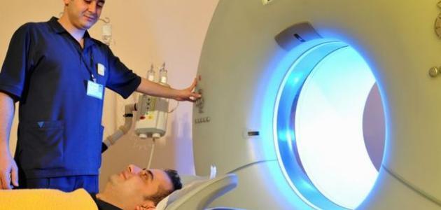 سرطان البروستات