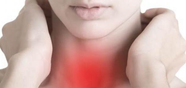 سرطان البلعوم