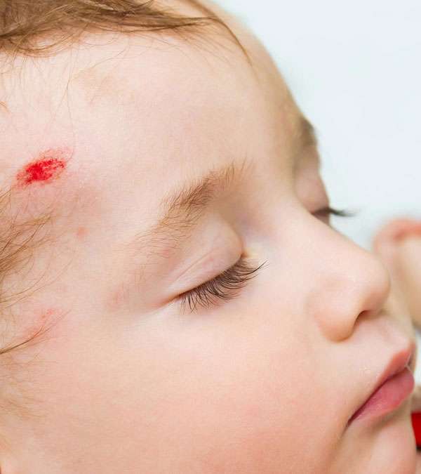 سقوط-الطفل-على-رأسه