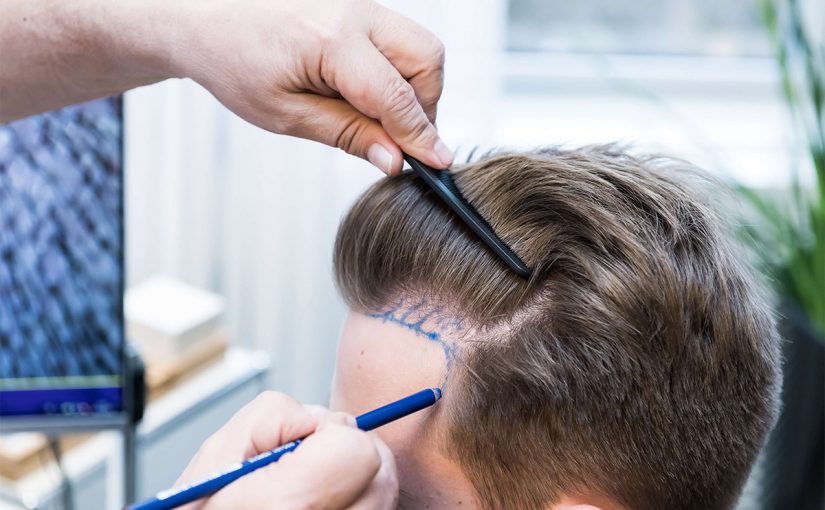 d8b4d8b9d8b1-825x510-2 تكلفة زراعة الشعر