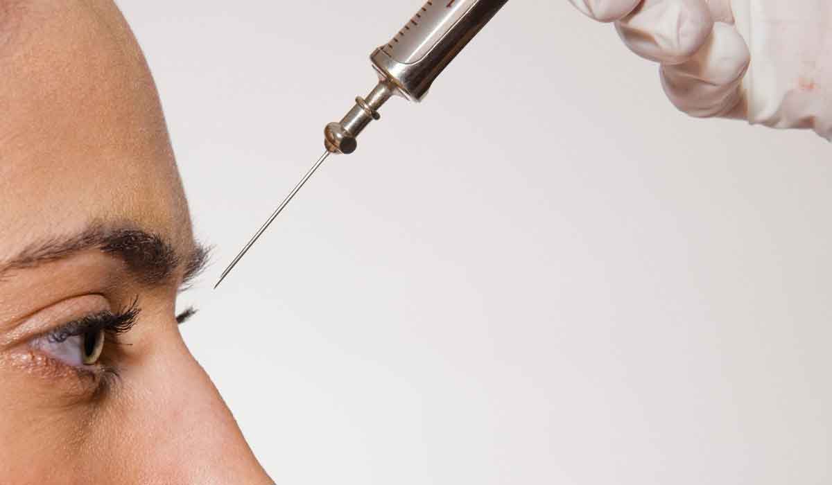 شفط-دهون-الانف-بدون-جراحه1