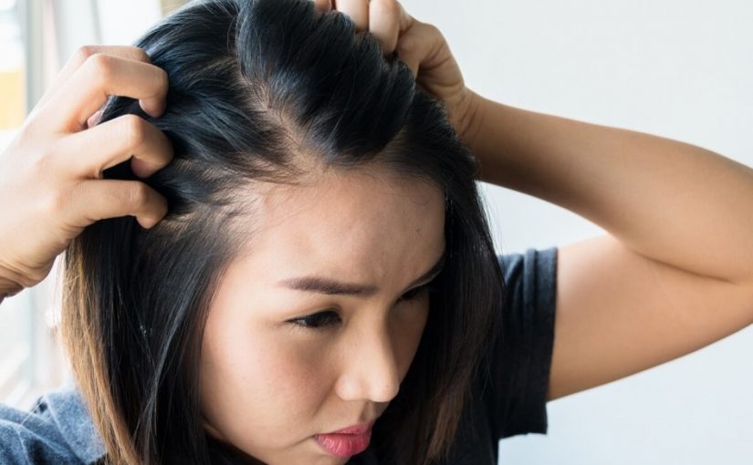 d8b9d984d8a7d8ac-d8a7d984d982d985d984-d8a8d8a7d984d982d8b1d981d987-825x510-2 علاج القمل بالقرفه