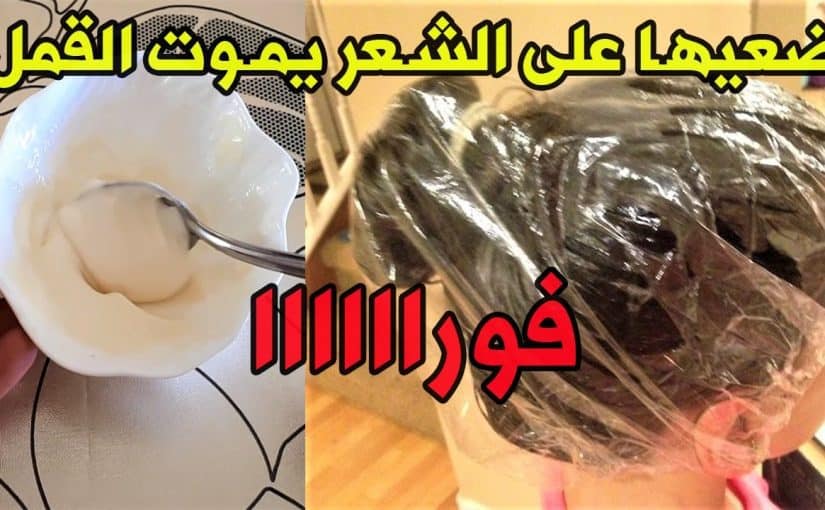 d8b9d984d8a7d8ac-d8a7d984d982d985d984-d988d8a7d984d8b5d98ad8a8d8a7d986-d986d987d8a7d8a6d98ad8a7d98b-825x510-2 علاج القمل والصيبان نهائياً