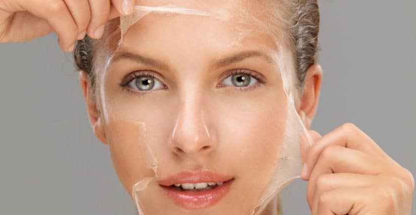 d8b9d984d8a7d8ac-d8aad982d8b4d98ad8b1-d8a7d984d988d8acd987-825x428-2 علاج تقشير الوجه