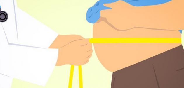 علاج ازالة الكرش