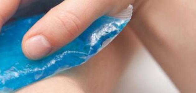 علاج الكدمات