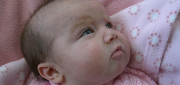 علاج اليرقان عند حديثي الولادة