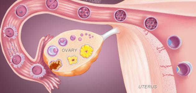 علاج انسداد قناة فالوب