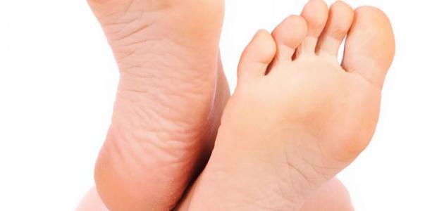 علاج حرارة القدمين بالأعشاب