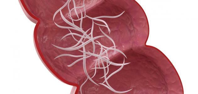 علاج دود البطن