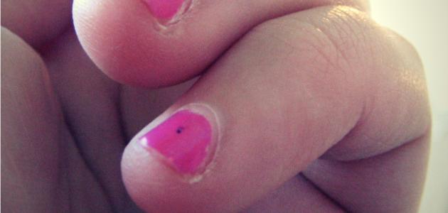 علاج للإصبع المدوحس