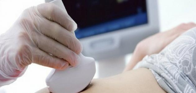 علامات اكيدة للحمل قبل الدورة